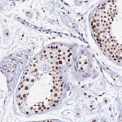 Invitrogen SNRPA1 Polyclonal Antibody 100 &mu;L; Unconjugated:Antibodies,