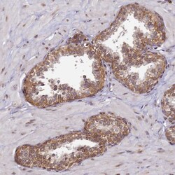 Invitrogen CCDC9 Polyclonal Antibody 100 &mu;L; Unconjugated:Antibodies,