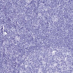 Invitrogen PATE4 Polyclonal Antibody 100 &mu;L; Unconjugated:Antibodies,