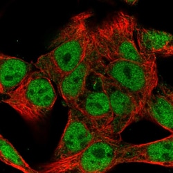 Invitrogen KIAA1033 Polyclonal Antibody 100 &mu;L; Unconjugated:Antibodies,