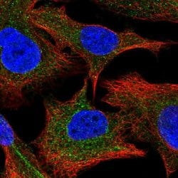 Invitrogen PPCDC Polyclonal Antibody 100 &mu;L; Unconjugated:Antibodies,