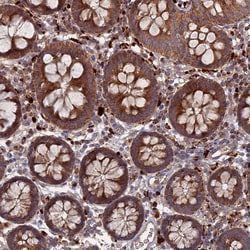 Invitrogen PPCDC Polyclonal Antibody 100 &mu;L; Unconjugated:Antibodies,
