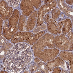 Invitrogen PPCDC Polyclonal Antibody 100 &mu;L; Unconjugated:Antibodies,