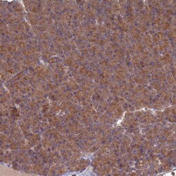 Invitrogen PPCDC Polyclonal Antibody 100 &mu;L; Unconjugated:Antibodies,