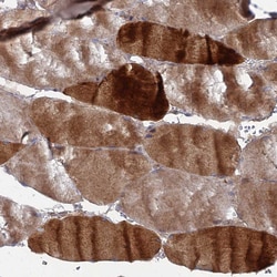 Invitrogen PPCDC Polyclonal Antibody 100 &mu;L; Unconjugated:Antibodies,