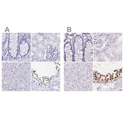 Invitrogen HDGFL1 Polyclonal Antibody 100 &mu;L; Unconjugated:Antibodies,