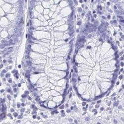 Invitrogen HDGFL1 Polyclonal Antibody 100 &mu;L; Unconjugated:Antibodies,