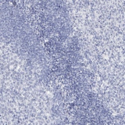 Invitrogen SSX2 Polyclonal Antibody 100 &mu;L; Unconjugated:Antibodies,