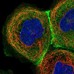 Invitrogen C17orf62 Polyclonal Antibody 100 &mu;L; Unconjugated:Anticuerpos