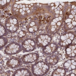 Invitrogen C17orf62 Polyclonal Antibody 100 &mu;L; Unconjugated:Anticuerpos