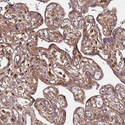 Invitrogen C17orf62 Polyclonal Antibody 100 &mu;L; Unconjugated:Anticuerpos