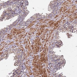 Invitrogen C17orf62 Polyclonal Antibody 100 &mu;L; Unconjugated:Anticuerpos