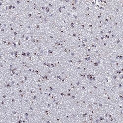 Invitrogen MEF2BNB Polyclonal Antibody 100 &mu;L; Unconjugated:Antibodies,