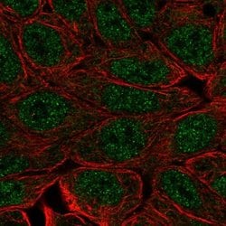 Invitrogen EVPLL Polyclonal Antibody 100 &mu;L; Unconjugated:Antibodies,
