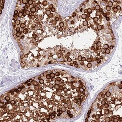 Invitrogen EVPLL Polyclonal Antibody 100 &mu;L; Unconjugated:Antibodies,