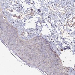 Invitrogen SPANXN4 Polyclonal Antibody 100 &mu;L; Unconjugated:Antibodies,