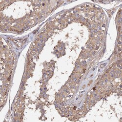 Invitrogen SPANXN4 Polyclonal Antibody 100 &mu;L; Unconjugated:Antibodies,