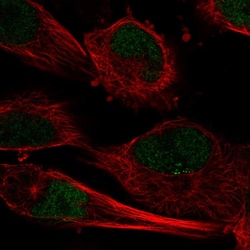 Invitrogen C10orf55 Polyclonal Antibody 100 &mu;L; Unconjugated:Antibodies,