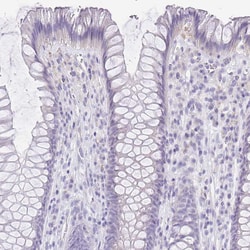 Invitrogen HAPLN2 Polyclonal Antibody 100 &mu;L; Unconjugated:Antibodies,