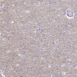 Invitrogen HAPLN2 Polyclonal Antibody 100 &mu;L; Unconjugated:Antibodies,