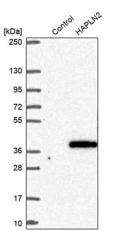 Invitrogen HAPLN2 Polyclonal Antibody 100 &mu;L; Unconjugated:Antibodies,