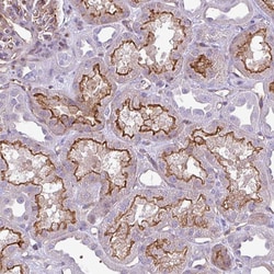 Invitrogen EME2 Polyclonal Antibody 100 &mu;L; Unconjugated:Antibodies,