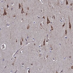 Invitrogen MOCS1 Polyclonal Antibody 100 &mu;L; Unconjugated:Antibodies,