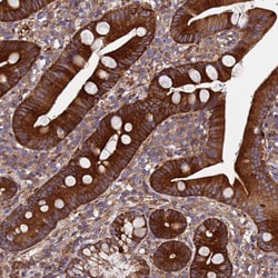 Invitrogen MOCS1 Polyclonal Antibody 100 &mu;L; Unconjugated:Antibodies,