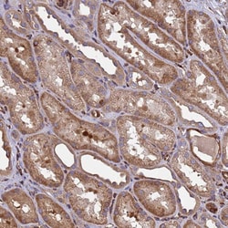 Invitrogen MOCS1 Polyclonal Antibody 100 &mu;L; Unconjugated:Antibodies,