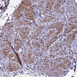 Invitrogen MOCS1 Polyclonal Antibody 100 &mu;L; Unconjugated:Antibodies,