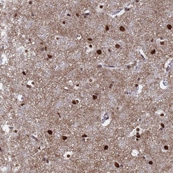 Invitrogen RAVER2 Polyclonal Antibody 100 &mu;L; Unconjugated:Antibodies,
