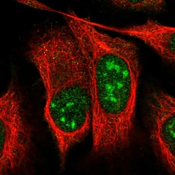 Invitrogen UTP11L Polyclonal Antibody 100 &mu;L; Unconjugated:Antibodies,
