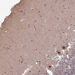 Invitrogen UTP11L Polyclonal Antibody 100 &mu;L; Unconjugated:Antibodies,