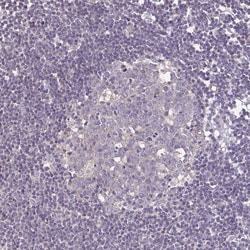 Invitrogen Desmoplakin Polyclonal Antibody 100 &mu;L; Unconjugated:Antibodies,