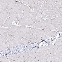 Invitrogen Desmoplakin Polyclonal Antibody 100 &mu;L; Unconjugated:Antibodies,