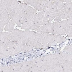 Desmoplakin Polyclonal Antibody, Invitrogen&trade; 100 &mu;L; Unconjugated 