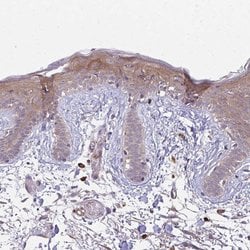 Desmoplakin Polyclonal Antibody, Invitrogen&trade; 100 &mu;L; Unconjugated 