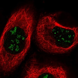 Invitrogen TBC1D13 Polyclonal Antibody 100 &mu;L; Unconjugated:Antibodies,