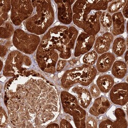 Invitrogen TBC1D13 Polyclonal Antibody 100 &mu;L; Unconjugated:Antibodies,