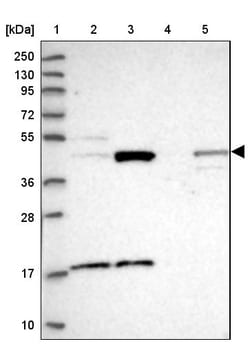 Invitrogen TBC1D13 Polyclonal Antibody 100 &mu;L; Unconjugated:Anticuerpos