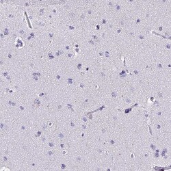Invitrogen MCM10 Polyclonal Antibody 100 &mu;L | Buy Online | Invitrogen&trade; | Fisher Scientific