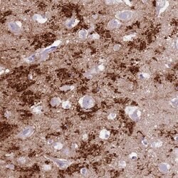 Invitrogen SLC7A14 Polyclonal Antibody 100 &mu;L; Unconjugated:Antibodies,