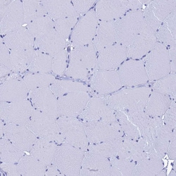 Invitrogen LIPF Polyclonal Antibody 100 &mu;L; Unconjugated:Antibodies,