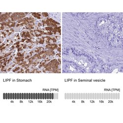 Invitrogen LIPF Polyclonal Antibody 100 &mu;L; Unconjugated:Antibodies,