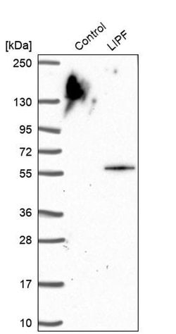 Invitrogen LIPF Polyclonal Antibody 100 &mu;L; Unconjugated:Antibodies,