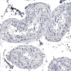 Invitrogen KRT77 Polyclonal Antibody 100 &mu;L; Unconjugated:Antibodies,