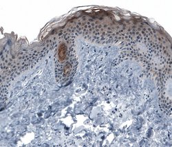 Invitrogen KRT77 Polyclonal Antibody 100 &mu;L; Unconjugated:Antibodies,