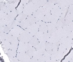 Invitrogen KRT77 Polyclonal Antibody 100 &mu;L; Unconjugated:Antibodies,