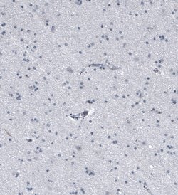 Invitrogen KRT77 Polyclonal Antibody 100 &mu;L; Unconjugated:Antibodies,