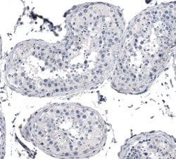 Invitrogen KRT77 Polyclonal Antibody 100 &mu;L; Unconjugated:Antibodies,
